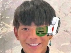 顶针